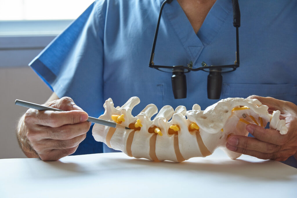 Doctor pointing to a lumbar vertebra model to explain a spinal condition